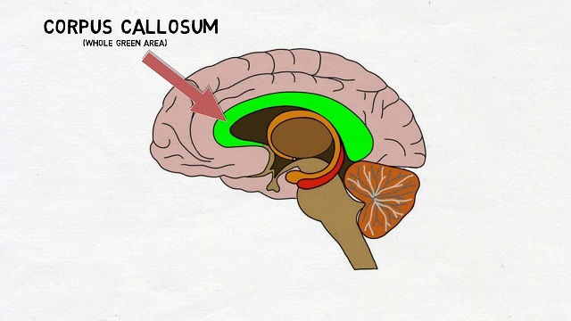 Corpus callosum